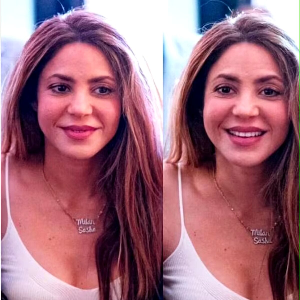 Acusan a Shakira de "abusar del botox" tras su más reciente aparición pública en Estados Unidos