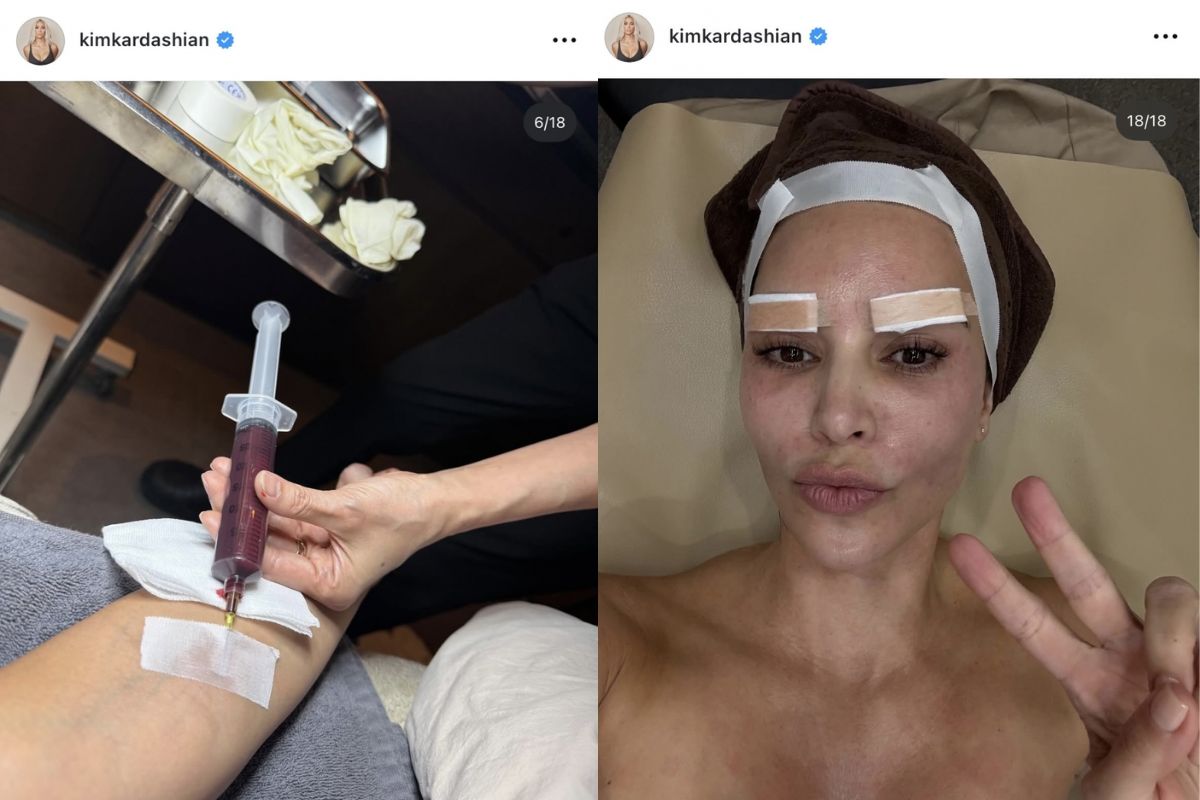 El tratamiento que se hizo Kim Kardashian en Corea del Sur para un rostro perfecto