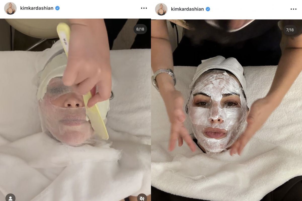 El tratamiento que se hizo Kim Kardashian en Corea del Sur para un rostro perfecto